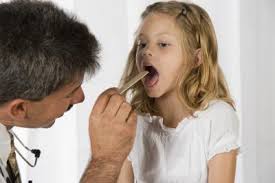 tonsilitis