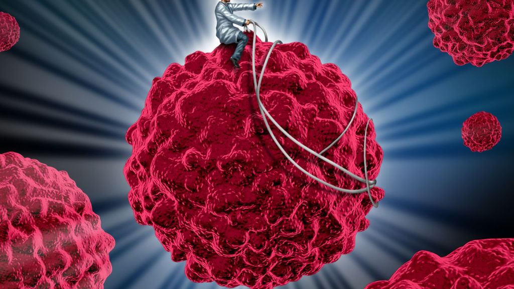 Šokujúce vyjadrenia experta: Liečba rakoviny je na vysokej úrovni, ale často liečime predražene, zbytočne a pacientovi&nbsp;škodíme
